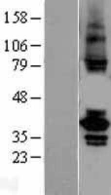Western Blot: TSSK2 Overexpression Lysate [NBL1-17394]