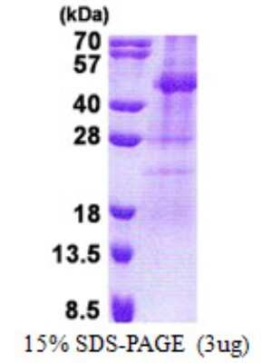SDS-PAGE: Recombinant Human TSSK2 His Protein [NBP2-22856]