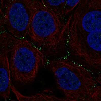 Immunocytochemistry/ Immunofluorescence: TSSK4 Antibody [NBP2-56284]