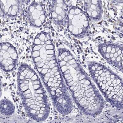 Immunohistochemistry-Paraffin: TSSK4 Antibody [NBP2-62713]