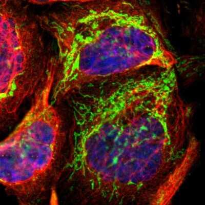 Immunocytochemistry/ Immunofluorescence: TST Antibody [NBP1-87147]