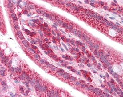 Immunohistochemistry: TST Antibody [NBP1-54682]