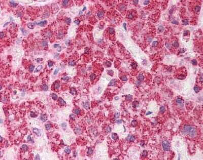 Immunohistochemistry: TST Antibody [NBP1-54682]
