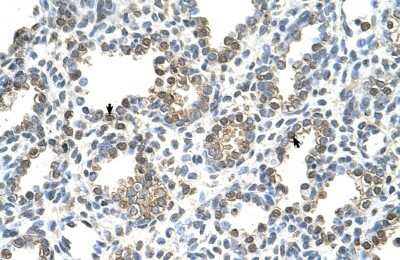 Immunohistochemistry-Paraffin: TST Antibody [NBP1-54682]