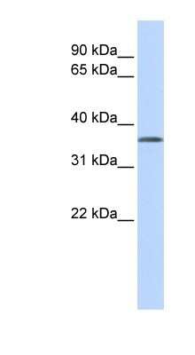 Western Blot: TSTA3 Antibody [NBP1-59130]