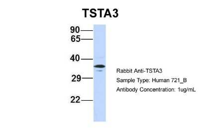 Western Blot: TSTA3 Antibody [NBP1-59130]