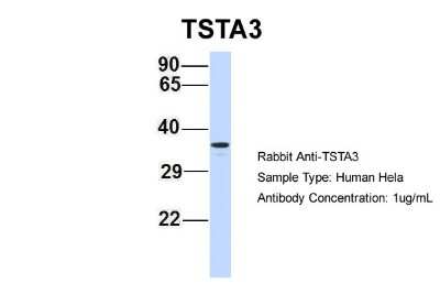 Western Blot: TSTA3 Antibody [NBP1-59130]