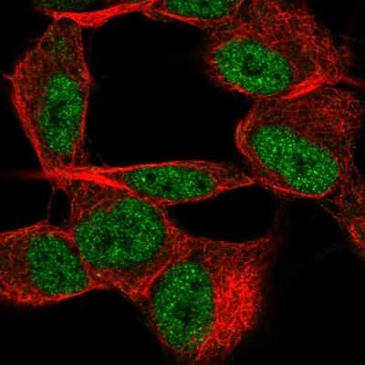 Immunocytochemistry/ Immunofluorescence: TSTD2 Antibody [NBP2-57276]