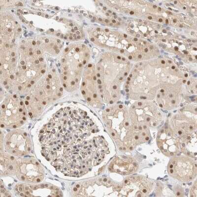 Immunohistochemistry-Paraffin: TSTD2 Antibody [NBP1-86695]