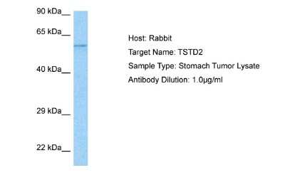 Western Blot: TSTD2 Antibody [NBP2-88508]