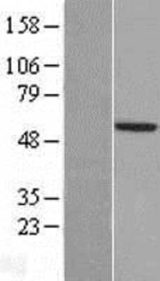 Western Blot: TSTD2 Overexpression Lysate [NBL1-08608]
