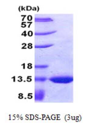 SDS-PAGE: Recombinant E. coli TSTD2 His Protein [NBP2-22640]