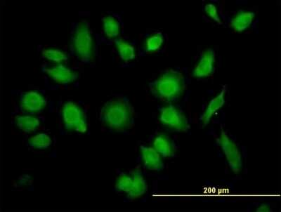 Immunocytochemistry/ Immunofluorescence: TTC1 Antibody [H00007265-B01P]