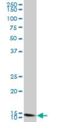 Western Blot: TTC11 Antibody (3G6) [H00051024-M02]
