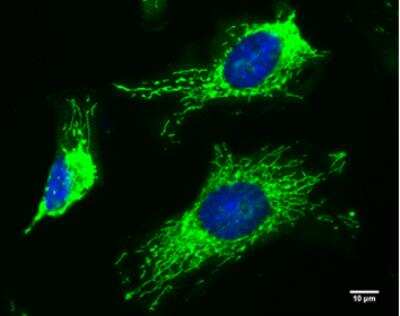 Immunocytochemistry/ Immunofluorescence: TTC11 Antibody (4211) [NBP2-43771]
