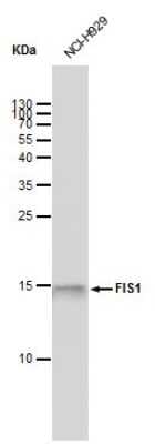 Western Blot: TTC11 Antibody (9810) [NBP2-43628]