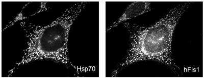 Immunocytochemistry/ Immunofluorescence: TTC11 Antibody [NBP2-80111]