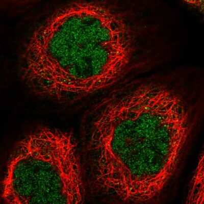 Immunocytochemistry/ Immunofluorescence: TTC12 Antibody [NBP1-83693]