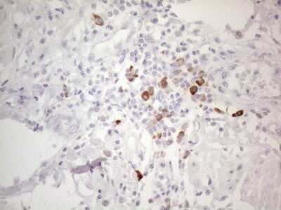 Immunohistochemistry: TTC14 Antibody (OTI9E11) [NBP2-46239]