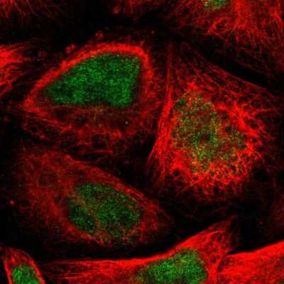 Immunocytochemistry/ Immunofluorescence: TTC14 Antibody [NBP1-84657]