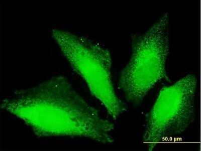 Immunocytochemistry/ Immunofluorescence: TTC15 Antibody [H00051112-B01P]