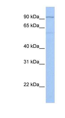 Western Blot: TTC16 Antibody [NBP1-55177]