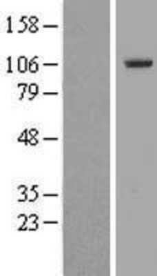 Western Blot: TTC16 Overexpression Lysate [NBL1-17399]
