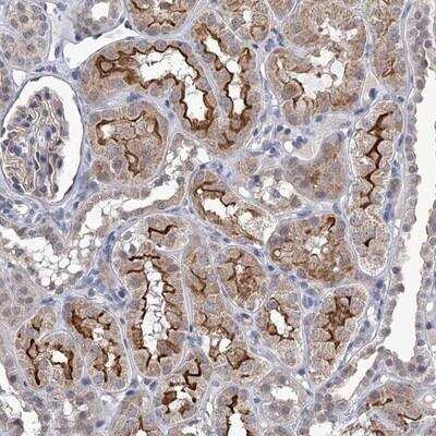 Immunohistochemistry-Paraffin: TTC17 Antibody [NBP1-83816]