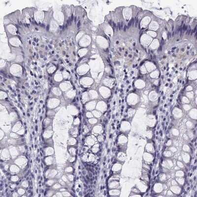 Immunohistochemistry-Paraffin: TTC18 Antibody [NBP2-62668]