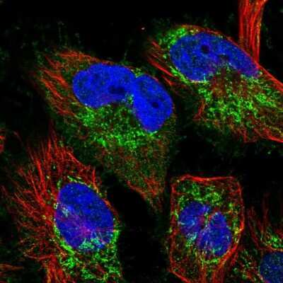 Immunocytochemistry/ Immunofluorescence: TTC19 Antibody [NBP2-38667]