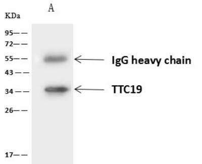 Immunoprecipitation: TTC19 Antibody [NBP2-98556]