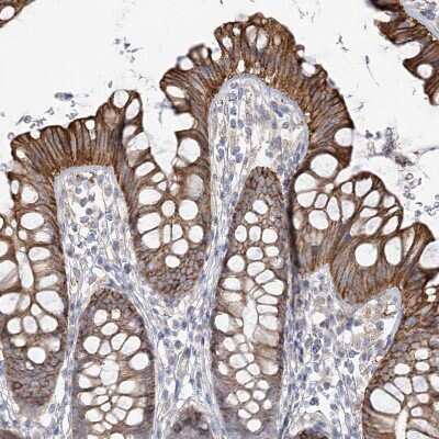 Immunohistochemistry-Paraffin: TTC21B Antibody [NBP1-90416]