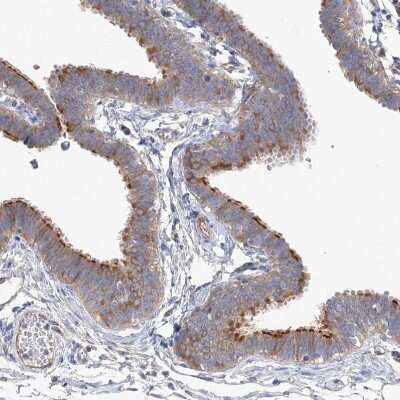 Immunohistochemistry-Paraffin: TTC21B Antibody [NBP1-90416]