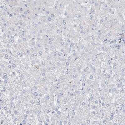 Immunohistochemistry-Paraffin: TTC21B Antibody [NBP1-90416]