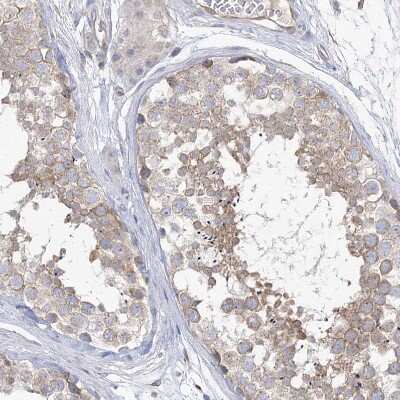 Immunohistochemistry-Paraffin: TTC21B Antibody [NBP1-90416]