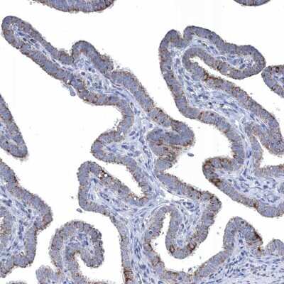 Immunohistochemistry-Paraffin: TTC21B Antibody [NBP2-37876]