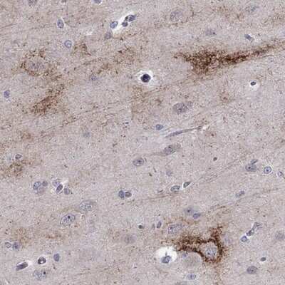 Immunohistochemistry-Paraffin: TTC21B Antibody [NBP3-17451]