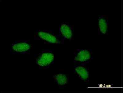 Immunocytochemistry/ Immunofluorescence: TTC23 Antibody [H00064927-B01P]