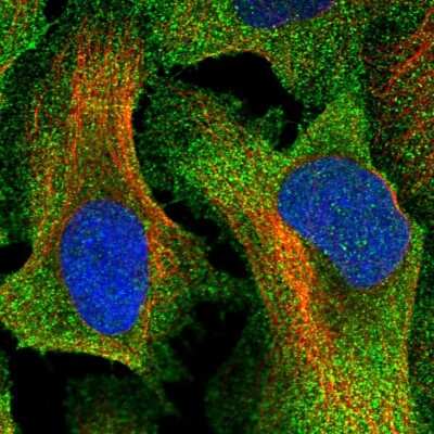 Immunocytochemistry/ Immunofluorescence: TTC23 Antibody [NBP1-83718]