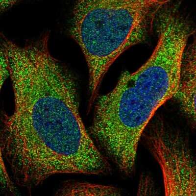 Immunocytochemistry/ Immunofluorescence: TTC31 Antibody [NBP1-82282]