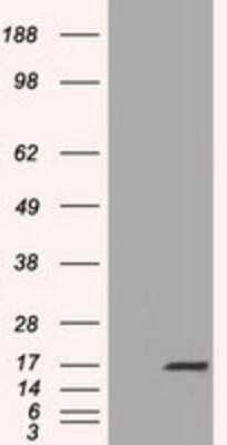 Western Blot: TTC32 Antibody (OTI1F7) [NBP2-02691]