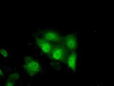Immunocytochemistry/ Immunofluorescence: TTC32 Antibody (OTI1F7) - Azide and BSA Free [NBP2-74656]