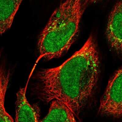 Immunocytochemistry/ Immunofluorescence: TTC33 Antibody [NBP1-82469]
