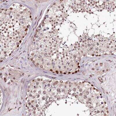 Immunohistochemistry: TTC33 Antibody [NBP1-82469]