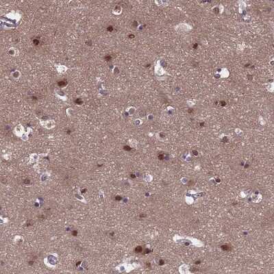 Immunohistochemistry-Paraffin: EMC2 Antibody [NBP2-13490]