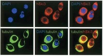 Immunocytochemistry/ Immunofluorescence: TTC37 Antibody [NBP2-59165]