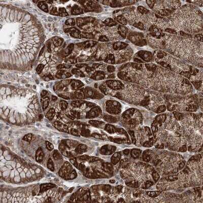 Immunohistochemistry-Paraffin: TTC37 Antibody [NBP1-93640]