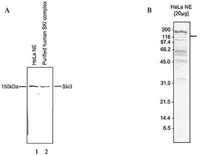 Western Blot: TTC37 Antibody [NBP2-59165]