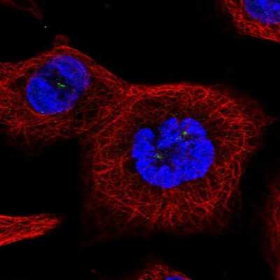 Immunocytochemistry/ Immunofluorescence: TTC39A Antibody [NBP2-58703]