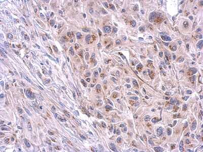 Immunohistochemistry-Paraffin: TTC39B Antibody [NBP2-15148]